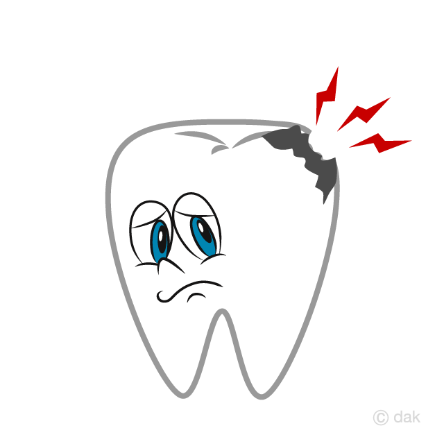 La caries dental
