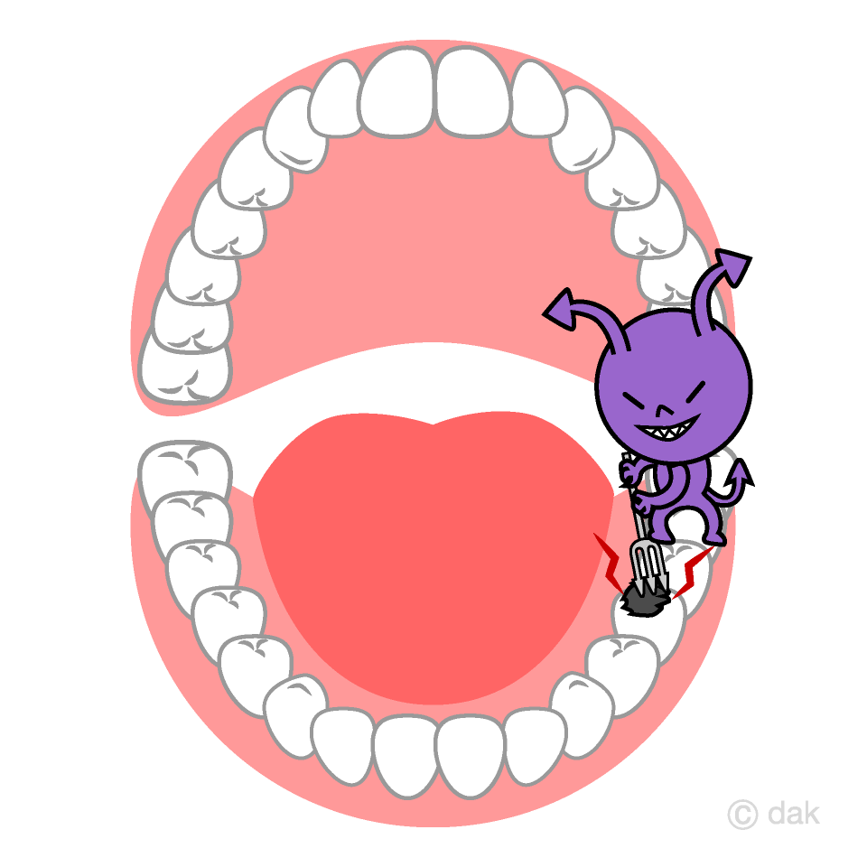 Caries en la boca