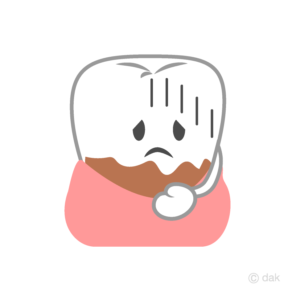 Lindo diente de enfermedad periodontal
