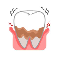 Terrible Periodontal Tooth